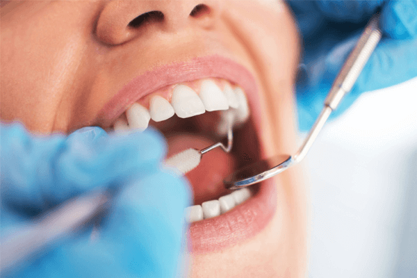 Sonhar com dentista: quais são os significados?