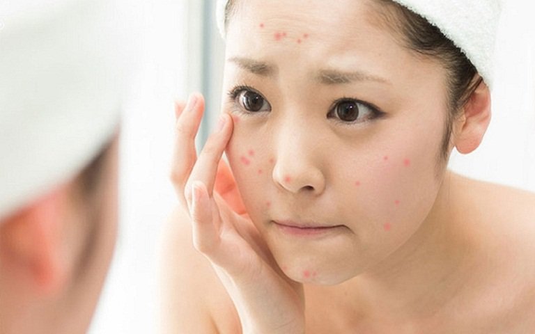 mơ thấy mụn